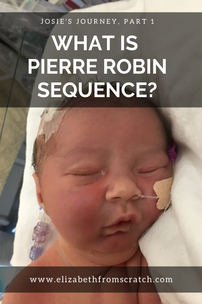 pierre robin sequence awareness day