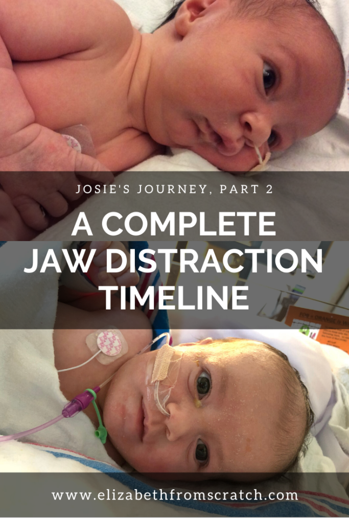 A Complete Timeline Of Jaw Distraction - Elizabeth From Scratch